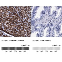 MyBPC3 Antibody, Novus Biologicals:Antibodies:Primary Antibodies